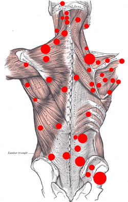 serratus posterior trigger point